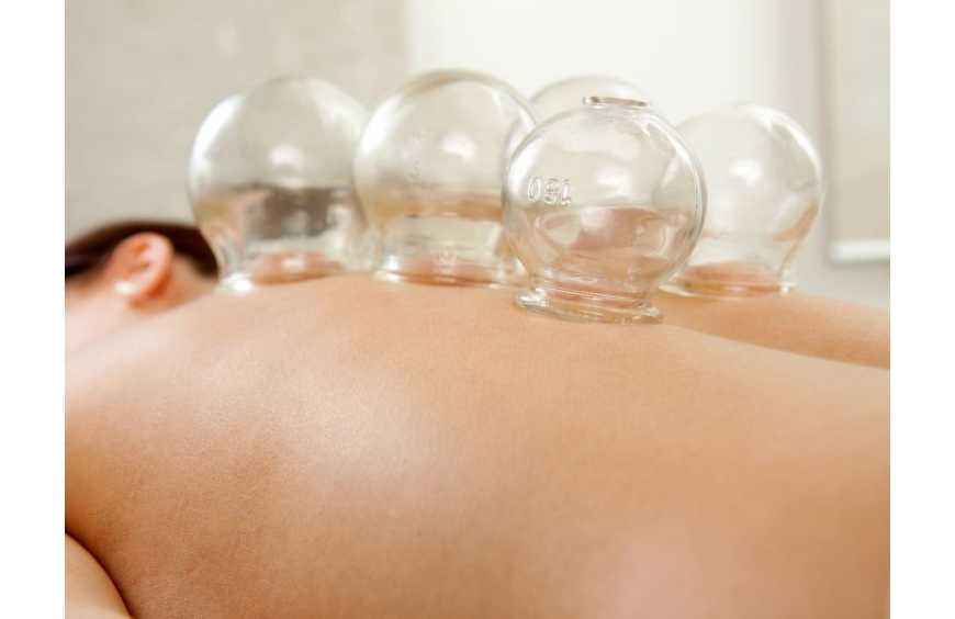 Coppettazione: benefici muscolari e benessere generale